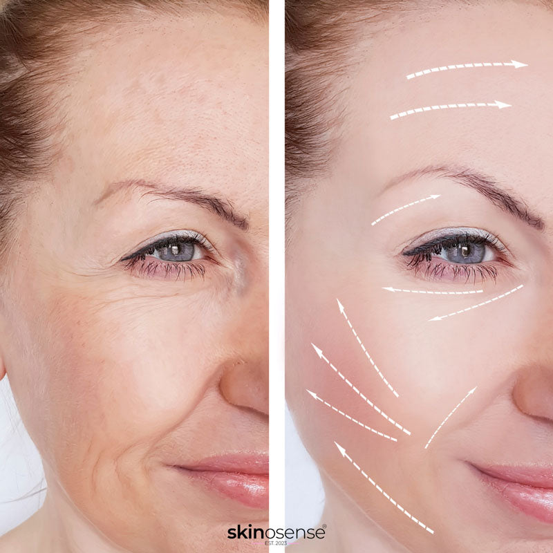 Microneedling-Set mit Soforteffekt – für sichtbar glattere, straffere Haut